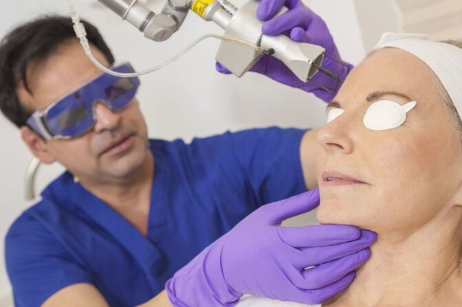 Skin rejuvenation with a laser